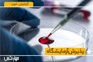 آزمایش خون