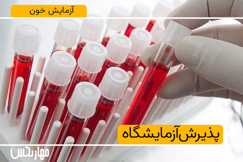 آزمایش خون